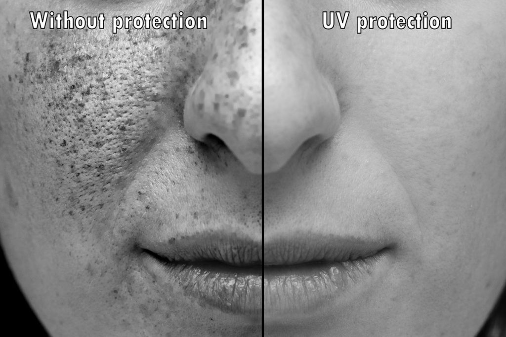 black and white photo showing skin with and without uv protection